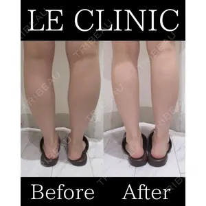 LE CLINICの症例