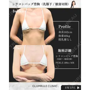GLAMRULE CLINIC (グラムルール クリニック) 銀座院 藤林 万里子医師の症例