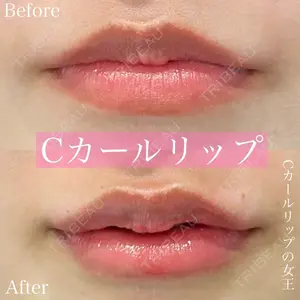 ルラ美容クリニック 渋谷本院 昼間 路子医師の症例