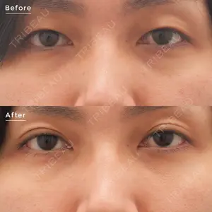 東京イセアクリニック 権東　容秀医師の症例