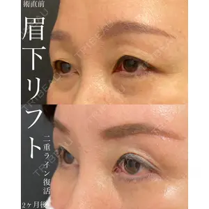 EMMO FACE CLINIC 大宮院 廣松 直樹医師の症例