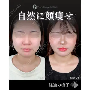 東京シンデレラ美容外科 池袋院 石井 達也医師の症例