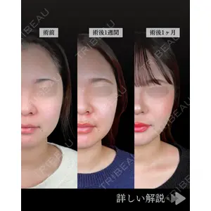 東京シンデレラ美容外科 池袋院 石井 達也医師の症例