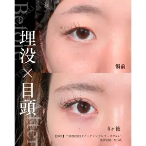 東京シンデレラ美容外科 大宮院 竹田 昌平医師の症例