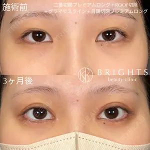 BRIGHTS beauty clinic 今村 直樹医師の症例