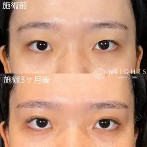 BRIGHTS beauty clinic 今村 直樹医師の症例