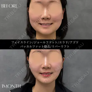 RIVER CLINIC（リバークリニック）大阪院の症例