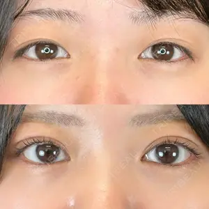 ルラ美容クリニック 札幌本院 早坂 亮哉医師の症例