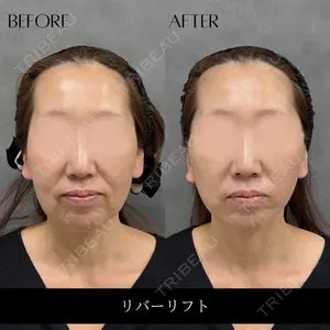 RIVER CLINIC（リバークリニック）大阪院の症例