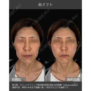 ネビュラクリニック 東京錦糸町院 岩切 琢磨医師の症例