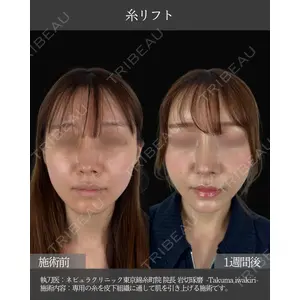 ネビュラクリニック 東京錦糸町院 岩切 琢磨医師の症例