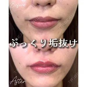 Tokyo Tensei Clinic 新宿院 小瀬 洸春医師の症例