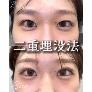 Tokyo Tensei Clinic 新宿院 小瀬 洸春医師の症例