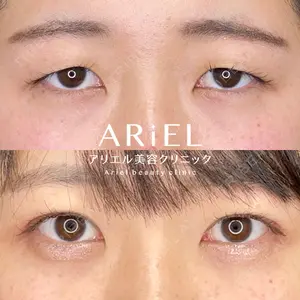 アリエル美容クリニック 大宮院 鈴木　桂介医師の症例