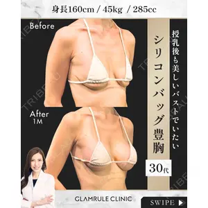 GLAMRULE CLINIC (グラムルール クリニック) 銀座院 藤林 万里子医師の症例