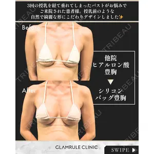 GLAMRULE CLINIC (グラムルール クリニック) 銀座院 藤林 万里子医師の症例