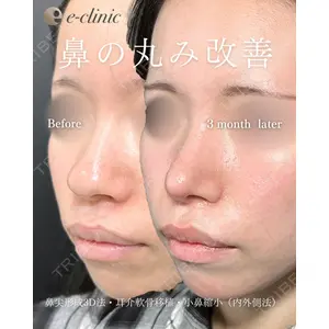 eクリニック 福岡院 伊藤 渉医師の症例