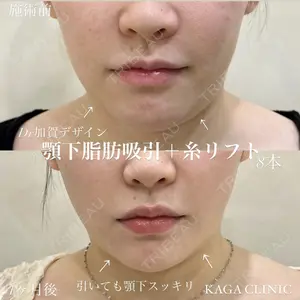 KAGA CLINIC 加賀 裕基医師の症例