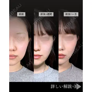 東京シンデレラ美容外科 池袋院 石井 達也医師の症例