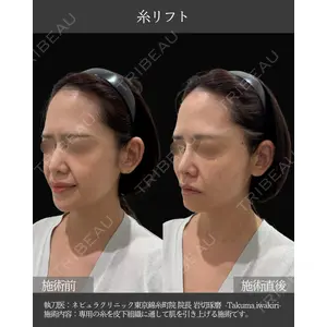 ネビュラクリニック 東京錦糸町院 岩切 琢磨医師の症例