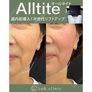 Lab.clinic札幌大通の症例