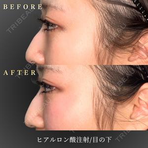 BiBiクリニック 山本 幸一郎医師の症例