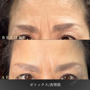 BiBiクリニック 山本 幸一郎医師の症例