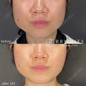 BRIGHTS beauty clinic 今村 直樹医師の症例