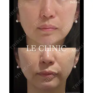 LE CLINIC 喜多　俊博医師の症例