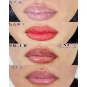 NARU Beauty Clinic 【ナルクリ】の症例