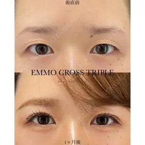 EMMO FACE CLINIC 大宮院 廣松 直樹医師の症例