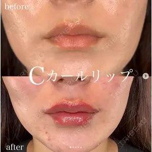 ルラ美容クリニック 大阪心斎橋院の症例