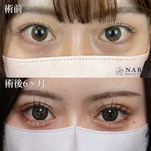 NARU Beauty Clinic 【ナルクリ】 石橋 成彦医師の症例