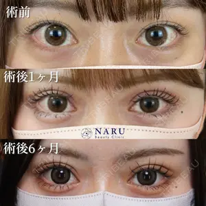 NARU Beauty Clinic 【ナルクリ】 石橋 成彦医師の症例