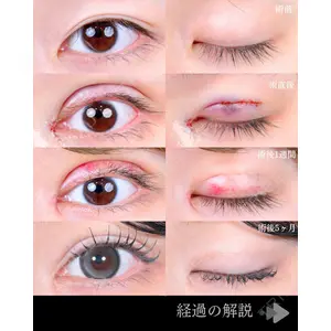 東京シンデレラ美容外科 池袋院 石井 達也医師の症例