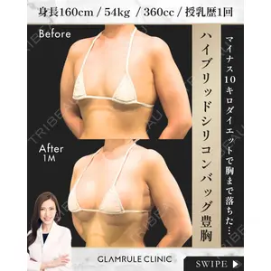 GLAMRULE CLINIC (グラムルール クリニック) 銀座院 藤林 万里子医師の症例