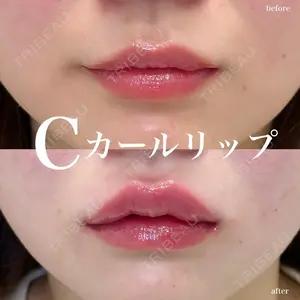 ルラ美容クリニック 名古屋栄院 / ルラスキンクリニック 名古屋栄院 関戸 優医師の症例