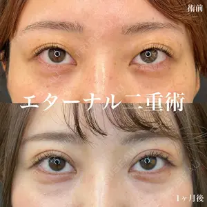 ルラ美容クリニック 名古屋栄院 / ルラスキンクリニック 名古屋栄院 関戸 優医師の症例