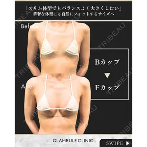 GLAMRULE CLINIC (グラムルール クリニック) 銀座院 藤林 万里子医師の症例
