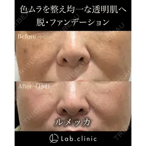 Lab.clinic札幌大通の症例