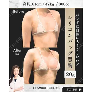 GLAMRULE CLINIC (グラムルール クリニック) 銀座院 藤林 万里子医師の症例
