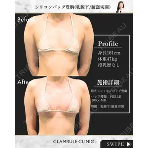 GLAMRULE CLINIC (グラムルール クリニック) 銀座院 藤林 万里子医師の症例