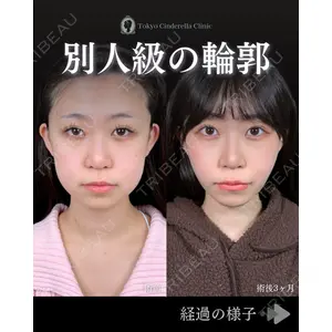 東京シンデレラ美容外科 池袋院 石井 達也医師の症例