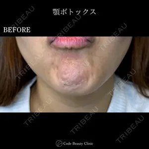 Code Beauty Clinic 名古屋院 橋本 祥平医師の症例