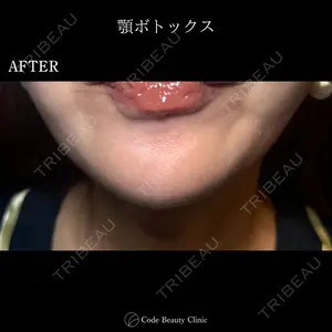 Code Beauty Clinic 名古屋院 橋本 祥平医師の症例