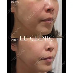 LE CLINICの症例