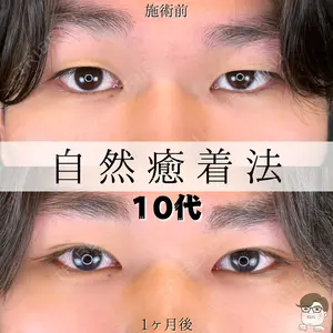 ルラ美容クリニック 札幌本院 佐藤 雄紀医師の症例