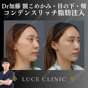 ルーチェクリニック 銀座院 加藤晴之輔医師の症例
