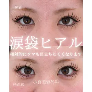 小暮整形外科・美容外科の症例