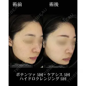HAAB BEAUTY CLINIC 名古屋院の症例